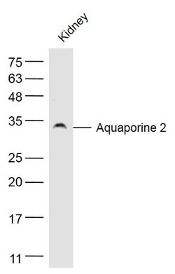 AQP2 Rabbit anti-Human, Polyclonal, Bioss 100 &mu;L; Unconjugated:Antibodies,
