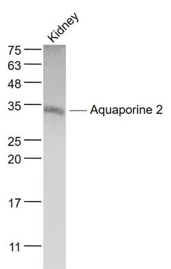 AQP2 Rabbit anti-Human, Polyclonal, Bioss 100 &mu;L; Unconjugated:Antibodies,