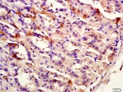 CK12 Rabbit anti-Human, Polyclonal, Bioss 100 &mu;L; Unconjugated:Antibodies,