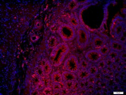 Layilin Rabbit anti-Human, Polyclonal, Bioss 100 &mu;L; Unconjugated:Antibodies,