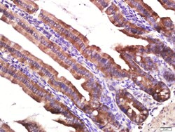 Layilin Rabbit anti-Human, Polyclonal, Bioss 100 &mu;L; Unconjugated:Antibodies,