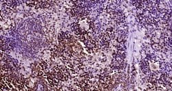 CD161c/NK1.1 Rabbit anti-Human, Polyclonal, Bioss 100 &mu;L; Unconjugated:Antibodies,