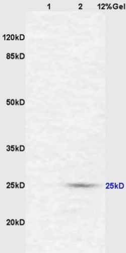 CD161c/NK1.1 Rabbit anti-Human, Polyclonal, Bioss 100 &mu;L; Unconjugated:Antibodies,