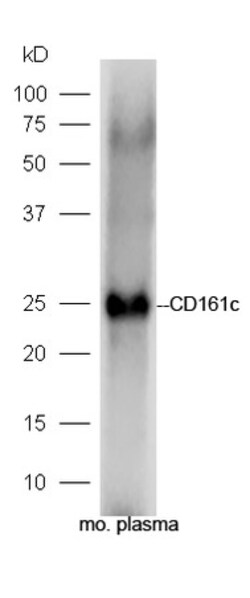 CD161c/NK1.1 Rabbit anti-Human, Polyclonal, Bioss 100 &mu;L; Unconjugated:Antibodies,