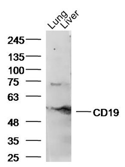 CD19 Rabbit anti-Human, Polyclonal, Bioss 100 &mu;L; Unconjugated:Antibodies,