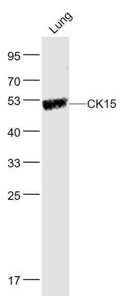 CK15 Rabbit anti-Human, Polyclonal, Bioss 100 &mu;L; Unconjugated:Antibodies,