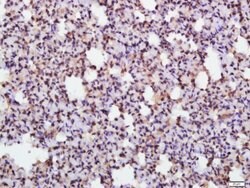 Phospho-eIF2 alpha subunit 1 (Ser52) Rabbit anti-Human, Polyclonal, Bioss