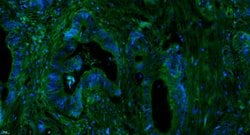 Complement C3d fragment Rabbit anti-Human, Polyclonal, Bioss 100 &mu;L;