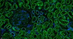 Complement C3d fragment Rabbit anti-Human, Polyclonal, Bioss 100 &mu;L;