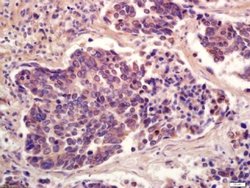 Phospho-PPAR Gamma (Ser273) Rabbit anti-Human, Polyclonal, Bioss 100 &mu;L;