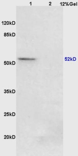 Phospho-PPAR Gamma (Ser273) Rabbit anti-Human, Polyclonal, Bioss 100 &mu;L;