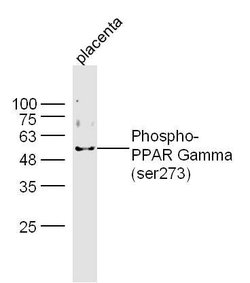 Phospho-PPAR Gamma (Ser273) Rabbit anti-Human, Polyclonal, Bioss 100 &mu;L;