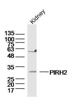 PIRH2 Rabbit anti-Human, Polyclonal, Bioss 100 &mu;L; Unconjugated:Antibodies,