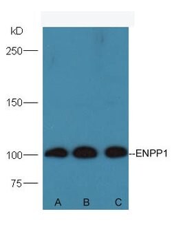 ENPP1 Rabbit anti-Human, Polyclonal, Bioss 100 &mu;L; Unconjugated:Antibodies,