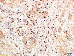 PAPOG Rabbit anti-Human, Polyclonal, Bioss 100 &mu;L; Unconjugated:Antibodies,