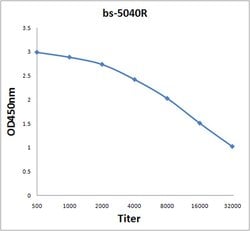 BAAT Rabbit anti-Human, Polyclonal, Bioss 100 &mu;L; Unconjugated:Antibodies,