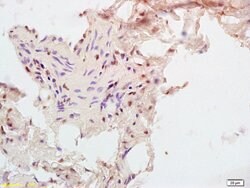 CPT1B Rabbit anti-Human, Polyclonal, Bioss 100 &mu;L; Unconjugated:Antibodies,