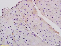 CPT1B Rabbit anti-Human, Polyclonal, Bioss 100 &mu;L; Unconjugated:Antibodies,