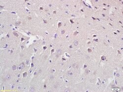 CROT Rabbit anti-Human, Polyclonal, Bioss 100 &mu;L | Buy Online | Bioss | Fisher Scientific