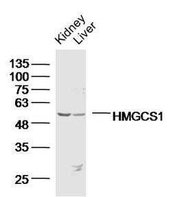HMGCS1 Rabbit anti-Human, Polyclonal, Bioss 100 &mu;L; Unconjugated:Antibodies,