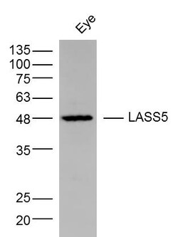 LASS5 Rabbit anti-Human, Polyclonal, Bioss 100 &mu;L; Unconjugated:Antibodies,