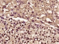 FHL2 Rabbit anti-Human, Polyclonal, Bioss 100 &mu;L; Unconjugated:Antibodies,