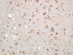 Phospho-AKT1/2/3 (Thr305, Thr308, Thr309) Rabbit anti-Human, Polyclonal,
