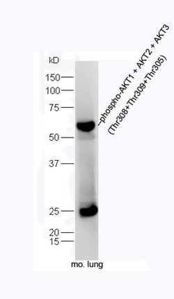 Phospho-AKT1/2/3 (Thr305, Thr308, Thr309) Rabbit anti-Human, Polyclonal,