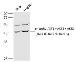 Phospho-AKT1/2/3 (Thr305, Thr308, Thr309) Rabbit anti-Human, Polyclonal,
