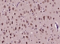 Phospho-AKT1 (Ser129) Rabbit anti-Human, Polyclonal, Bioss 100 &mu;L; Unconjugated:Antibodies,