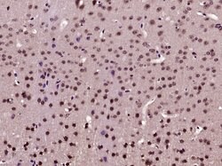 Phospho-AKT1 (Ser129) Rabbit anti-Human, Polyclonal, Bioss 100 &mu;L; Unconjugated:Antibodies,