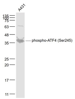 Phospho-ATF4 (Ser245) Rabbit anti-Human, Polyclonal, Bioss 100 &mu;L; Unconjugated:Antibodies,