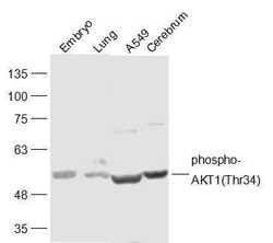 Phospho-AKT1 (Thr34) Rabbit anti-Human, Polyclonal, Bioss 100 &mu;L; Unconjugated:Antibodies,