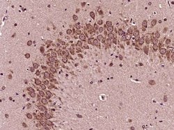 Phospho-Bad (Ser118) Rabbit anti-Human, Polyclonal, Bioss 100 &mu;L | Buy Online | Bioss | Fisher Scientific