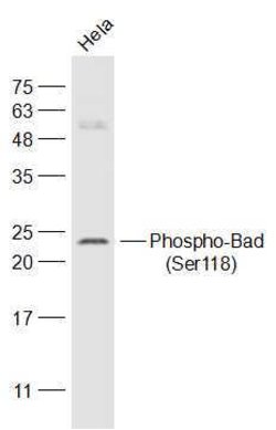 Phospho-Bad (Ser118) Rabbit anti-Human, Polyclonal, Bioss 100 &mu;L | Buy Online | Bioss | Fisher Scientific