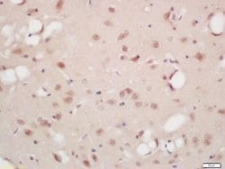 Phospho-B-Raf (Ser446) Rabbit anti-Human, Polyclonal, Bioss 100 &mu;L | Buy Online | Bioss | Fisher Scientific