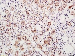 Phospho-DAXX (Ser517) Rabbit anti-Human, Polyclonal, Bioss 100 &mu;L; Unconjugated:Antibodies,