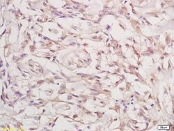 Phospho-FGFR1/FGFR2 (Tyr463, Tyr466) Rabbit anti-Human Mouse Rat, Polyclonal,