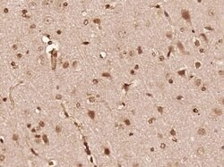 Phospho-FGFR1/FGFR2 (Tyr463, Tyr466) Rabbit anti-Human Mouse Rat, Polyclonal,