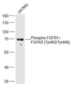 Phospho-FGFR1/FGFR2 (Tyr463, Tyr466) Rabbit anti-Human Mouse Rat, Polyclonal,