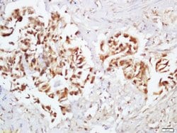 Phospho-Ep300 (Ser1834) Rabbit anti-Human, Polyclonal, Bioss 100 &mu;L;