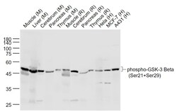 Phospho-GSK-3 Beta (Ser21, Ser29) Polyclonal Antibody, Bioss 100 &mu;L;