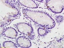 Phospho-IL-1R1 (Tyr496) Rabbit anti-Human, Polyclonal, Bioss 100 &mu;L;