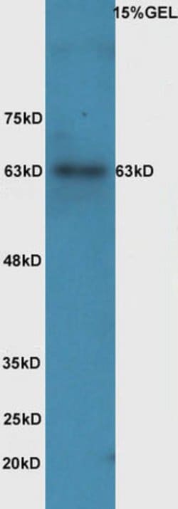 Phospho-IL-1R1 (Tyr496) Rabbit anti-Human, Polyclonal, Bioss 100 &mu;L;