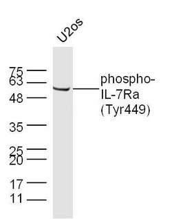 Phospho-IL-7Ra (Tyr449) Rabbit anti-Human, Polyclonal, Bioss 100 &mu;L;