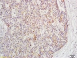 Phospho-TAK1 (Ser192) Rabbit anti-Human, Polyclonal, Bioss 100 &mu;L; Unconjugated:Antibodies,
