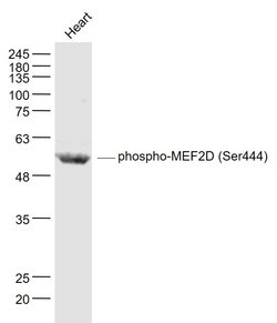 Phospho-MEF2D (Ser444) Rabbit anti-Human, Polyclonal, Bioss 100 &mu;L | Buy Online | Bioss | Fisher Scientific