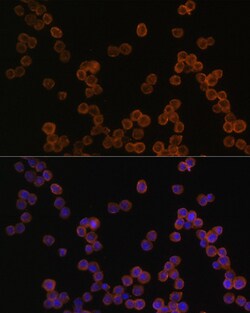 CD44 Polyclonal Antibody, Bioss 100 &mu;L; Unconjugated:Antibodies, Polyclonal