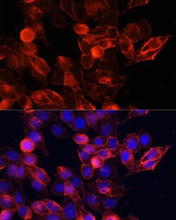 CD44 Polyclonal Antibody, Bioss 100 &mu;L; Unconjugated:Antibodies, Polyclonal