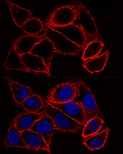 CD44 Polyclonal Antibody, Bioss 100 &mu;L; Unconjugated:Antibodies, Polyclonal
